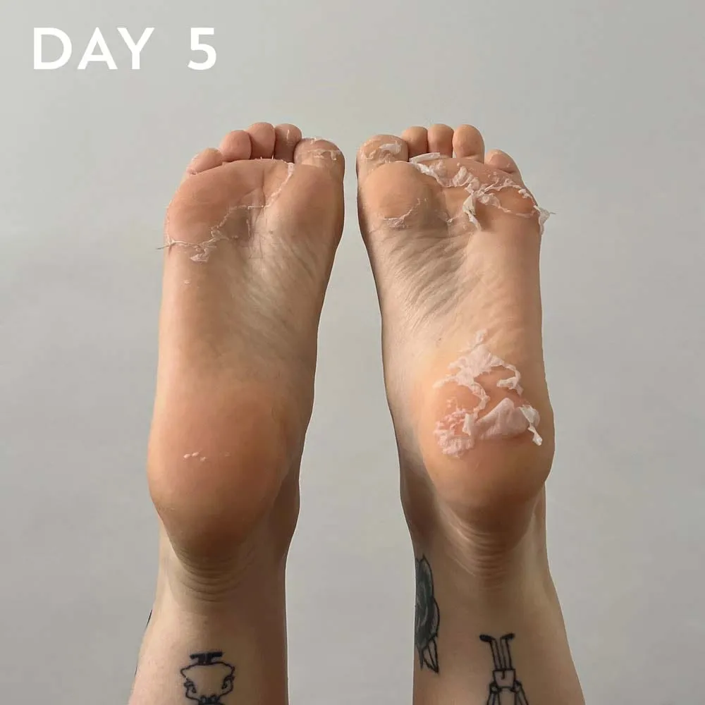 BEAUTYPRO Foot & Callus Peel
